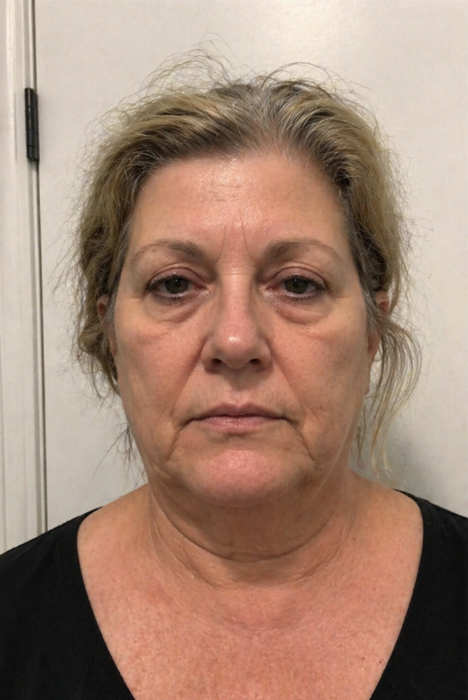 Diane R., 52 before